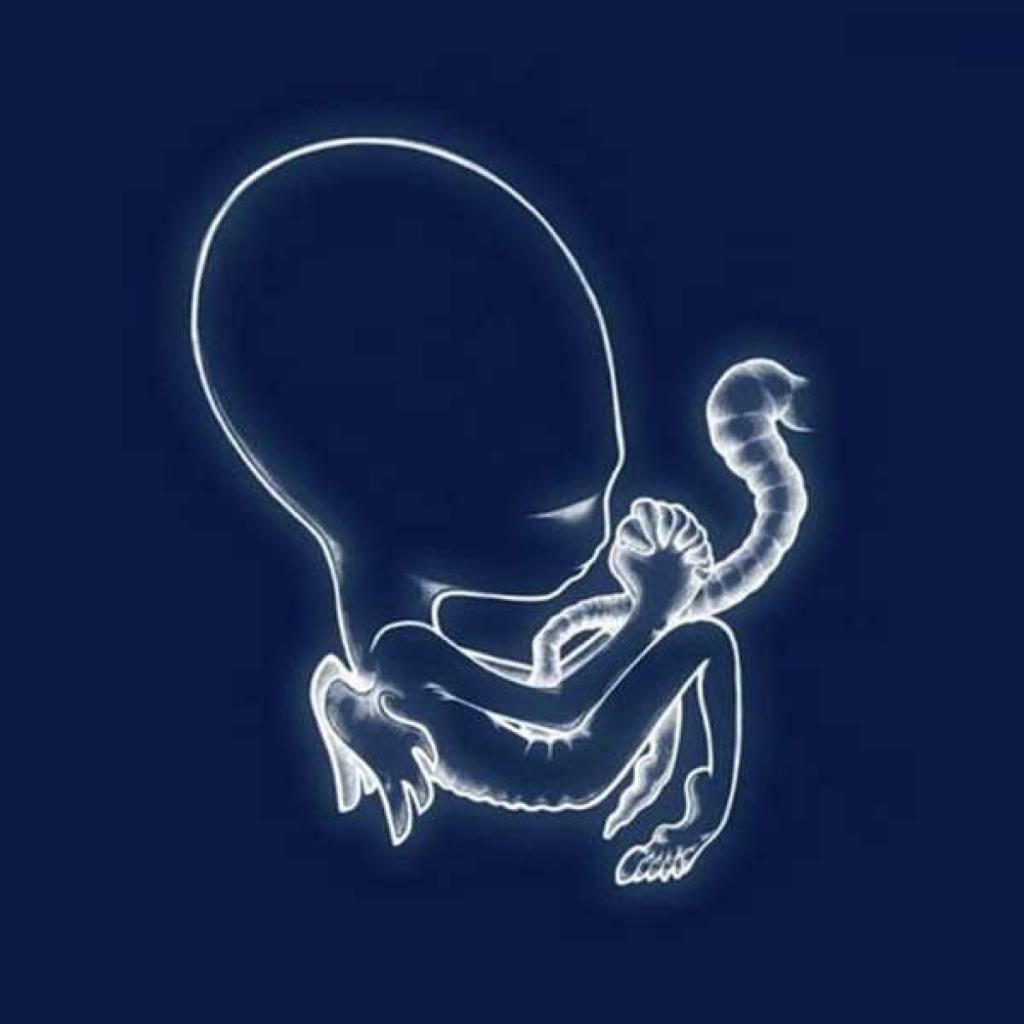 Sigur Ros - Agaetis Byrjun