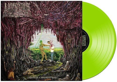 Undeath - Lesions Of A Different Kind [Slim Green Vinyl]  (New Vinyl LP)
