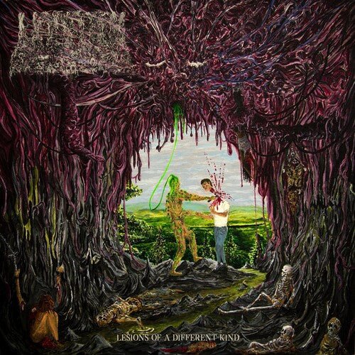 Undeath - Lesions Of A Different Kind [Slim Green Vinyl]  (New Vinyl LP)